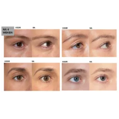 L'Oreal Lu0027Oréal Clinically Proven Wimperserum -Vitaal Glam Verkoopwinkel 994623 4